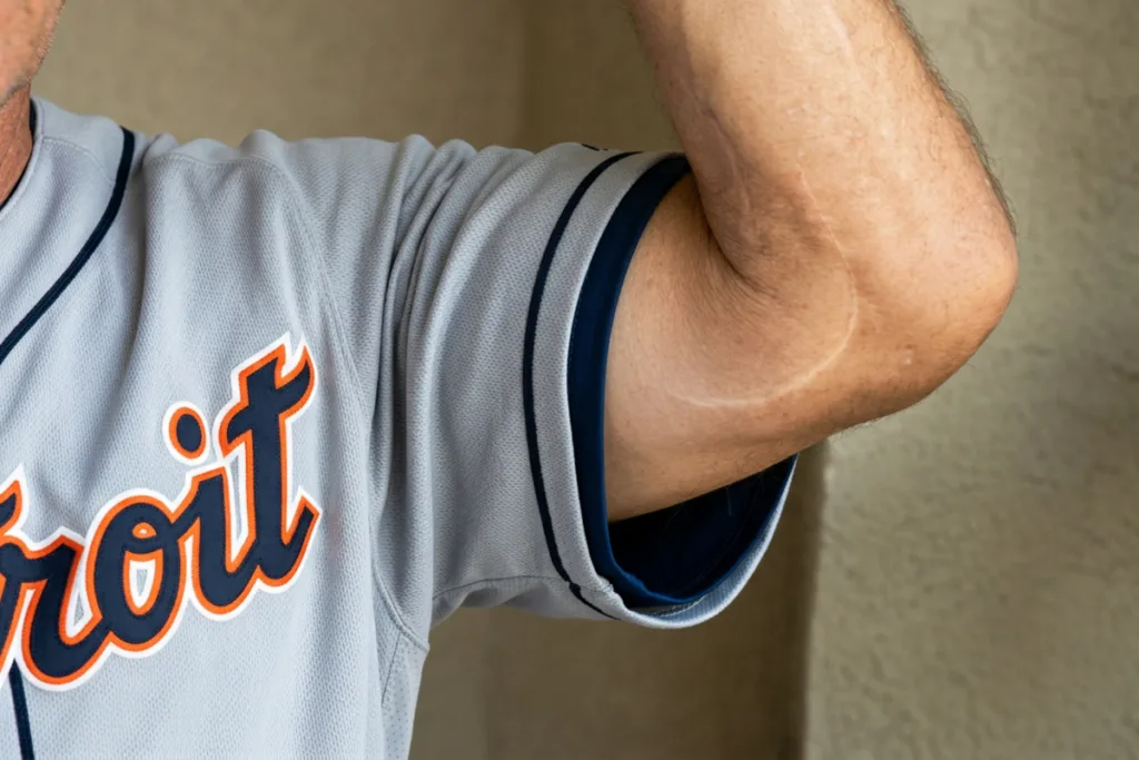 Tarik Skubal trade, Detroit Tigers, elbow